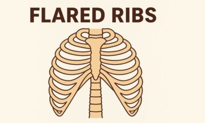 Flared Ribs
