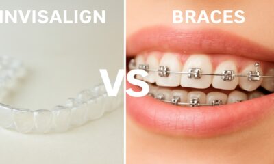 Invisalign vs Braces