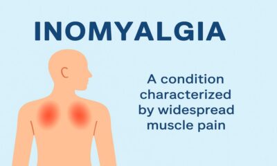 Inomyalgia