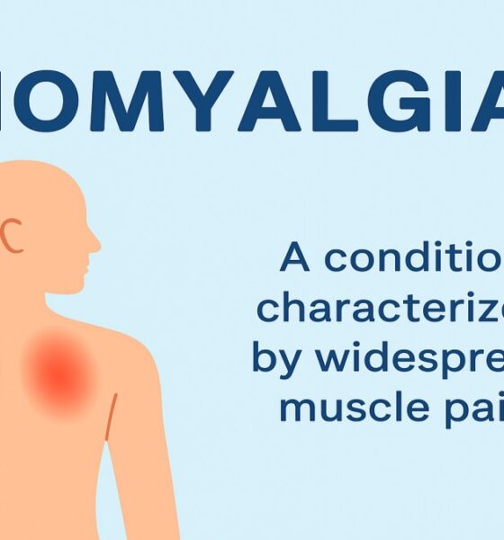 Inomyalgia